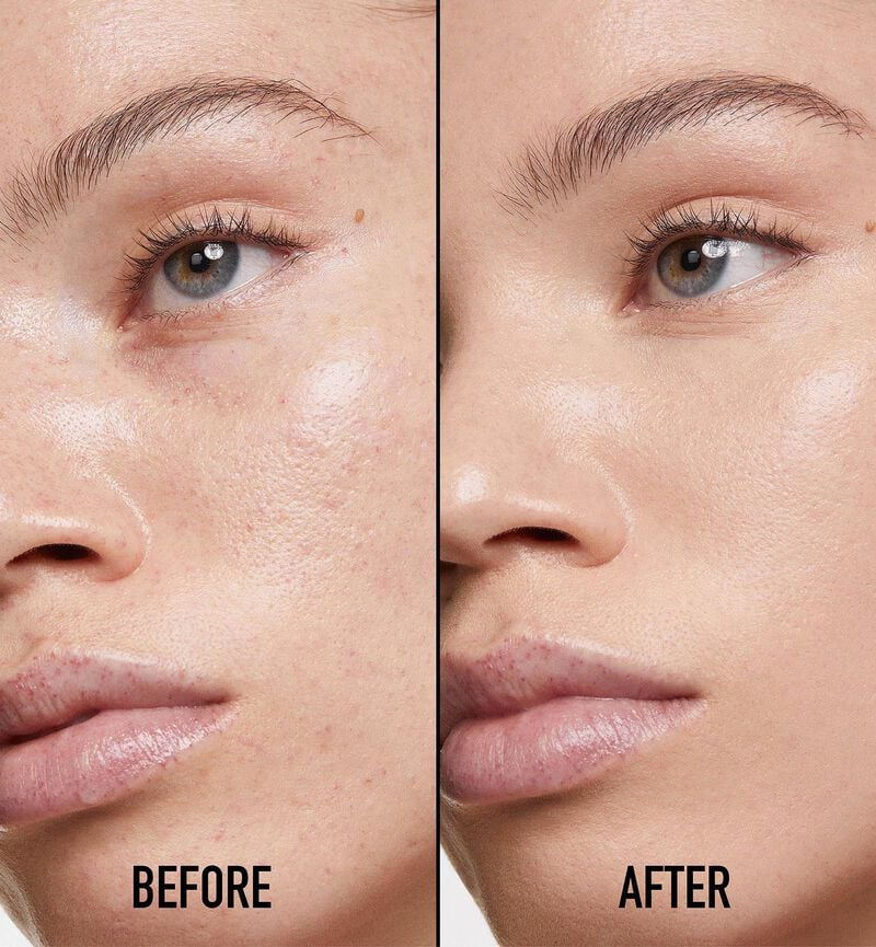 Dior Forever Skin Correct Full-Coverage Concealer